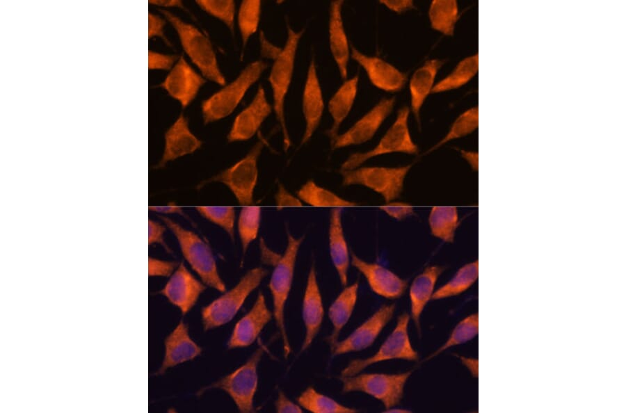 Immunofluorescence - Anti-LHPP Antibody (A89113) - Antibodies.com