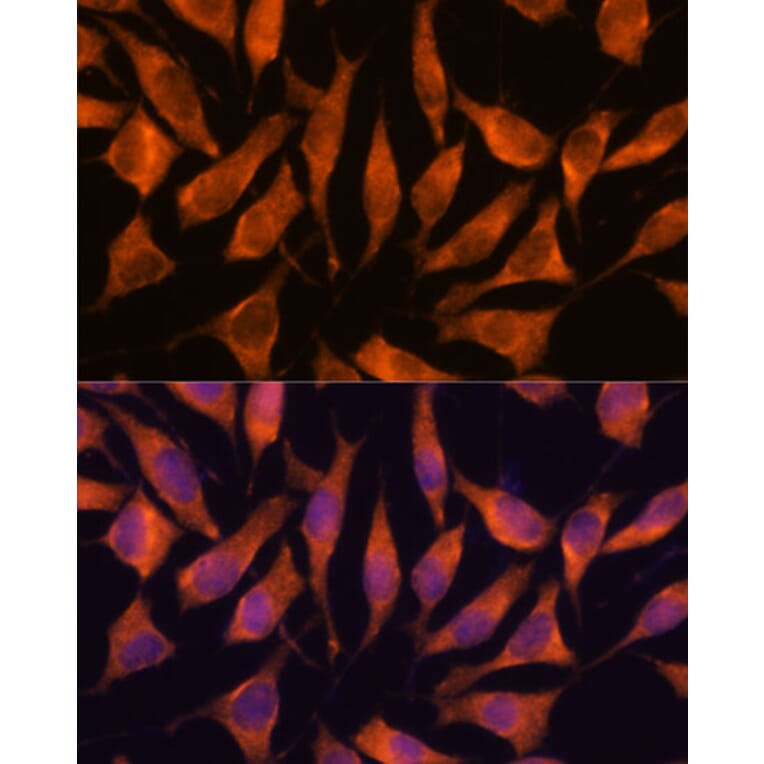 Immunofluorescence - Anti-LHPP Antibody (A89113) - Antibodies.com