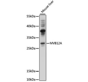 Western Blot - Anti-MVB12A Antibody (A89114) - Antibodies.com