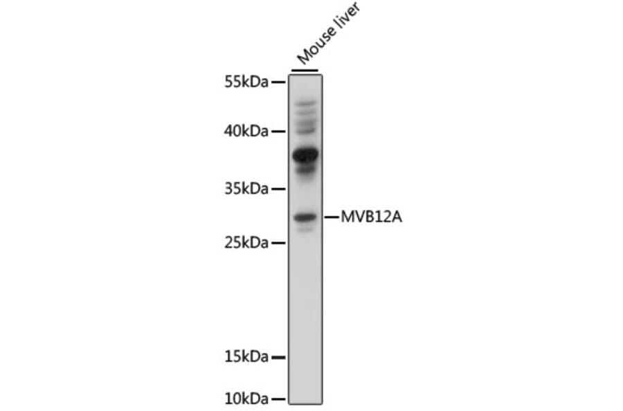 Western Blot - Anti-MVB12A Antibody (A89114) - Antibodies.com