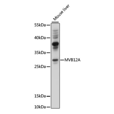 Western Blot - Anti-MVB12A Antibody (A89114) - Antibodies.com