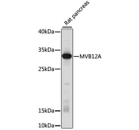 Western Blot - Anti-MVB12A Antibody (A89115) - Antibodies.com