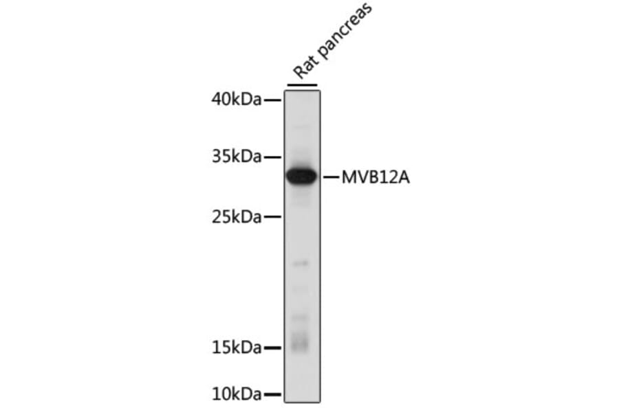 Western Blot - Anti-MVB12A Antibody (A89115) - Antibodies.com