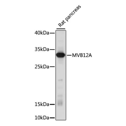 Western Blot - Anti-MVB12A Antibody (A89115) - Antibodies.com