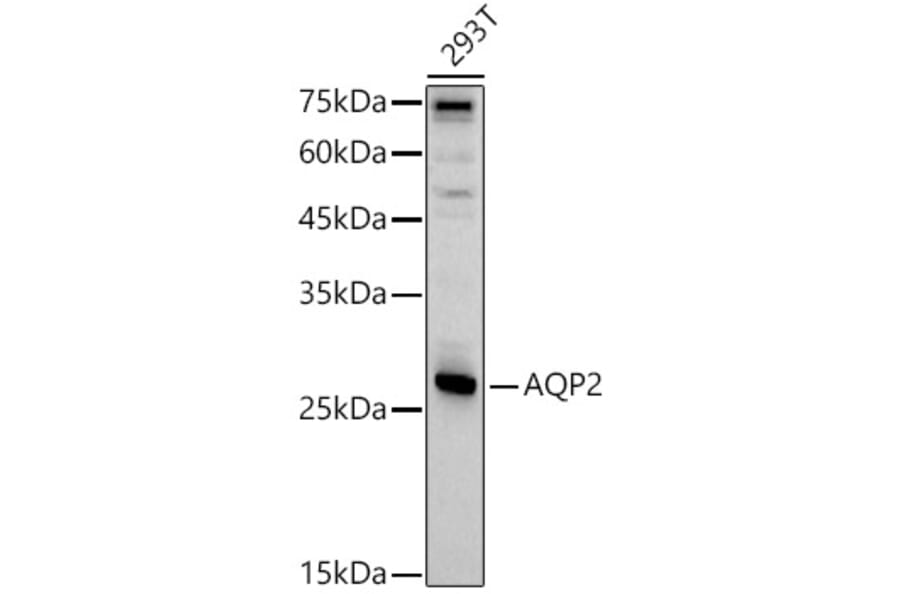 Western Blot - Anti-Aquaporin 2 Antibody (A89116) - Antibodies.com