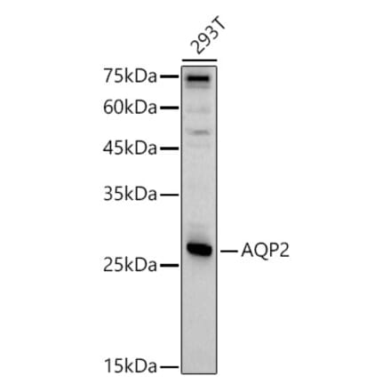 Western Blot - Anti-Aquaporin 2 Antibody (A89116) - Antibodies.com