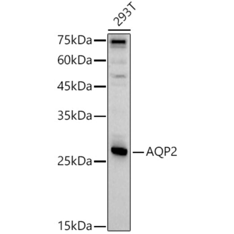 Western Blot - Anti-Aquaporin 2 Antibody (A89116) - Antibodies.com