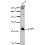 Western Blot - Anti-Aquaporin 2 Antibody (A89116) - Antibodies.com