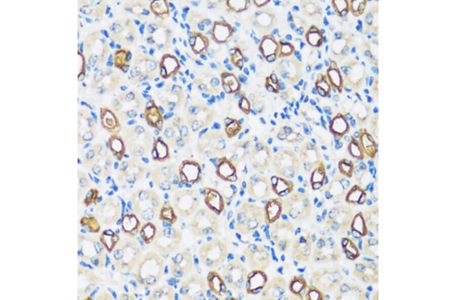 Immunohistochemistry - Anti-Aquaporin 2 Antibody (A89116) - Antibodies.com