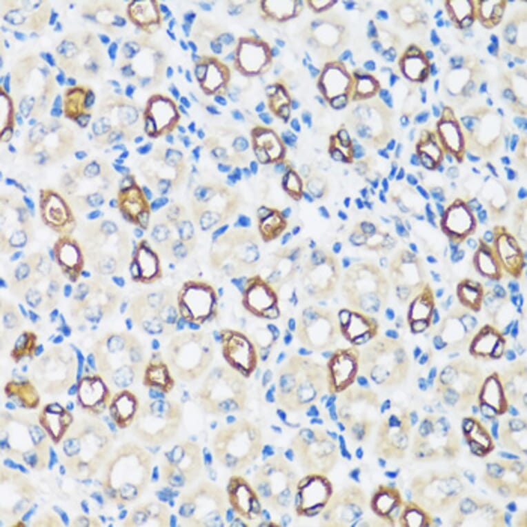 Immunohistochemistry - Anti-Aquaporin 2 Antibody (A89116) - Antibodies.com