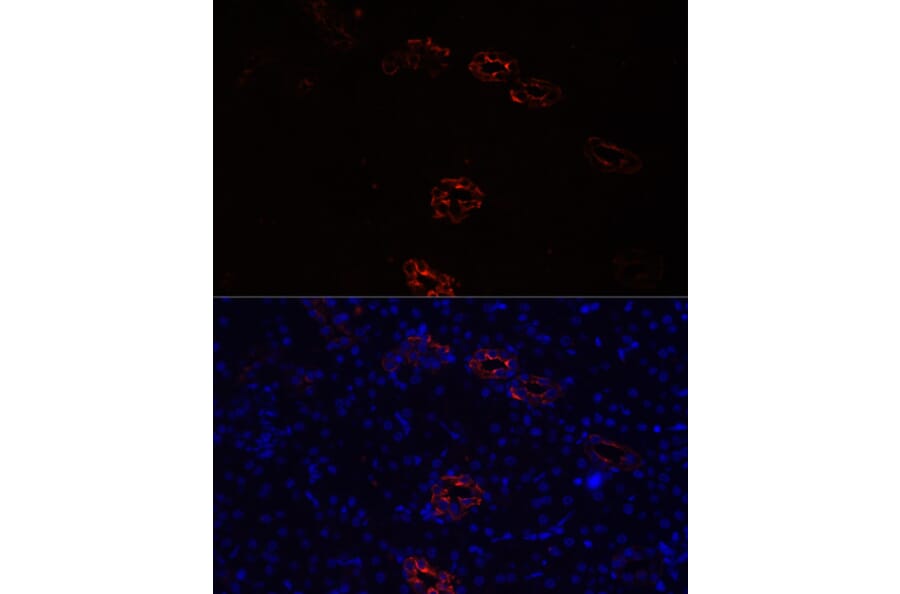 Immunofluorescence - Anti-Aquaporin 2 Antibody (A89116) - Antibodies.com