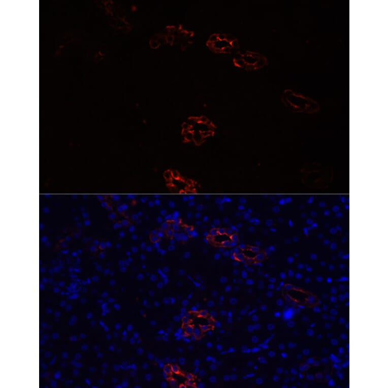 Immunofluorescence - Anti-Aquaporin 2 Antibody (A89116) - Antibodies.com