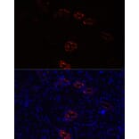 Immunofluorescence - Anti-Aquaporin 2 Antibody (A89116) - Antibodies.com