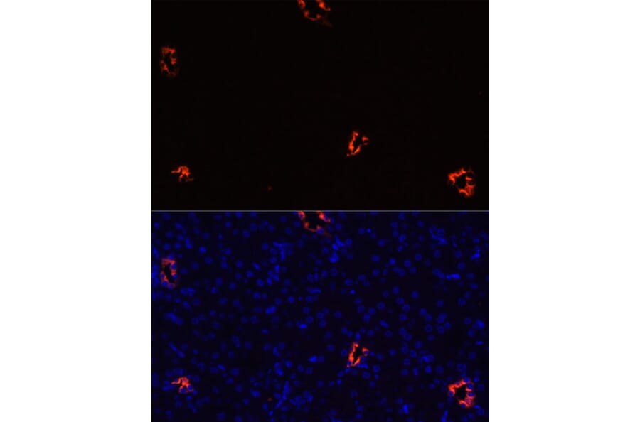 Immunofluorescence - Anti-Aquaporin 2 Antibody (A89116) - Antibodies.com