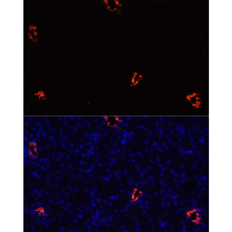 Immunofluorescence - Anti-Aquaporin 2 Antibody (A89116) - Antibodies.com