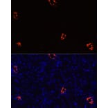 Immunofluorescence - Anti-Aquaporin 2 Antibody (A89116) - Antibodies.com