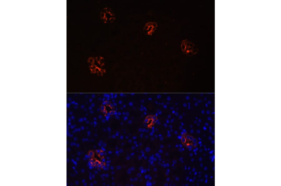 Anti-AQP2 Antibody (A89116) | Antibodies.com