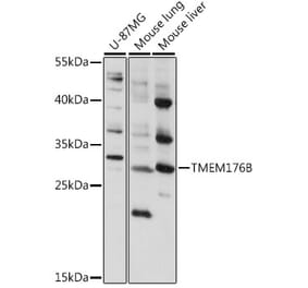 Western Blot - Anti-LR8 Antibody (A89117) - Antibodies.com