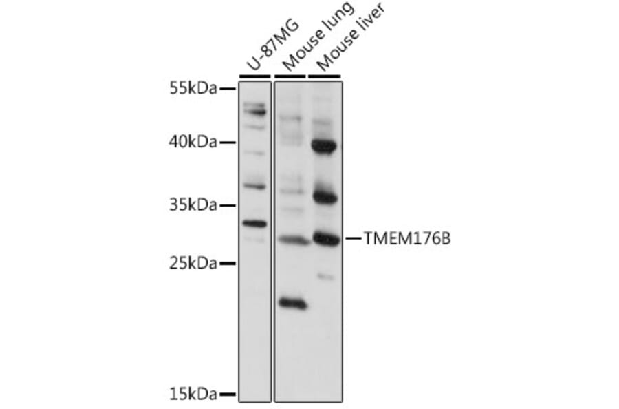 Western Blot - Anti-LR8 Antibody (A89117) - Antibodies.com