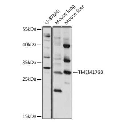 Western Blot - Anti-LR8 Antibody (A89117) - Antibodies.com
