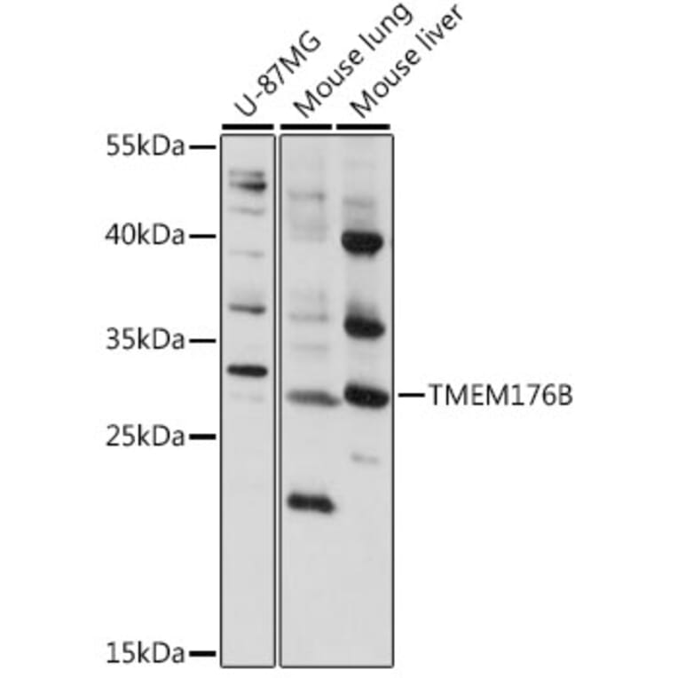 Western Blot - Anti-LR8 Antibody (A89117) - Antibodies.com