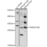 Western Blot - Anti-LR8 Antibody (A89117) - Antibodies.com