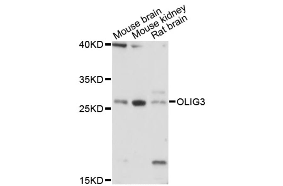 Western Blot - Anti-OLIG3 Antibody (A13715) - Antibodies.com