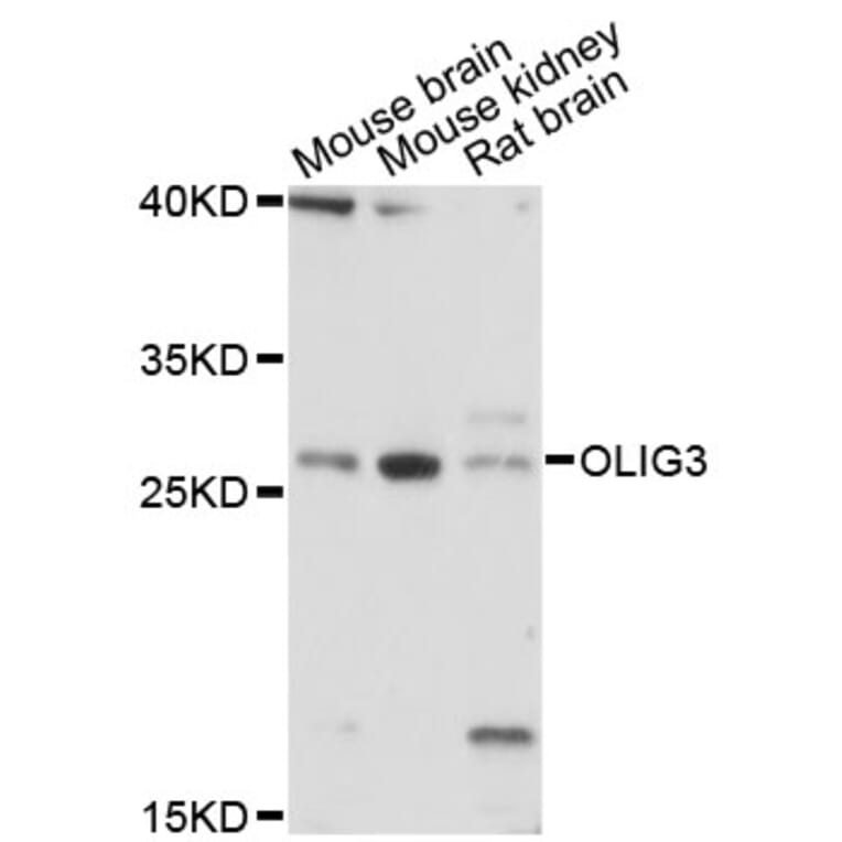 Western Blot - Anti-OLIG3 Antibody (A13715) - Antibodies.com