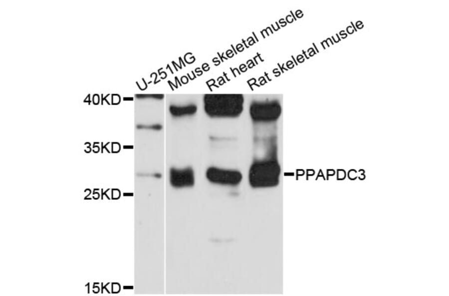 Western Blot - Anti-PPAPDC3 Antibody (A13882) - Antibodies.com