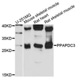 Western Blot - Anti-PPAPDC3 Antibody (A13882) - Antibodies.com