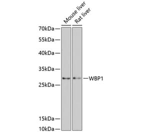 Western Blot - Anti-WBP1 Antibody (A89120) - Antibodies.com