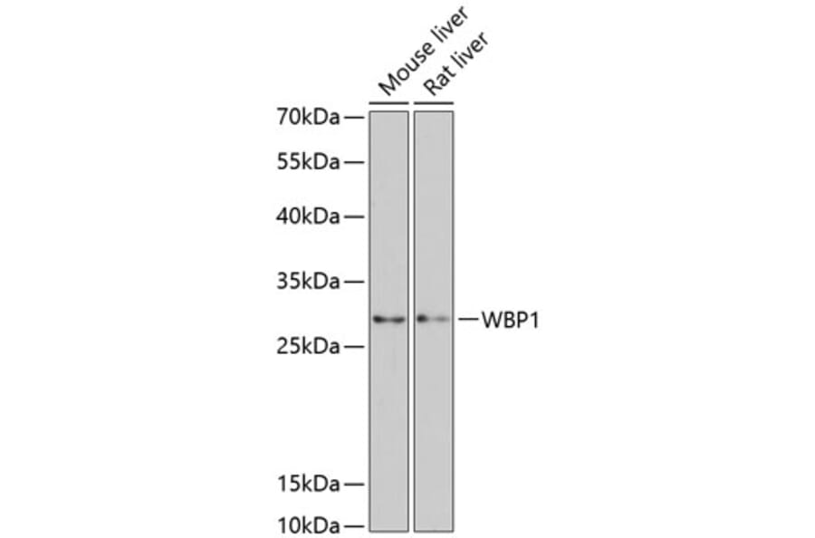 Western Blot - Anti-WBP1 Antibody (A89120) - Antibodies.com