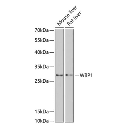 Western Blot - Anti-WBP1 Antibody (A89120) - Antibodies.com
