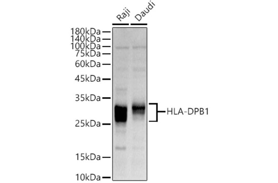 Western Blot - Anti-MHC Class II beta Antibody (A89121) - Antibodies.com
