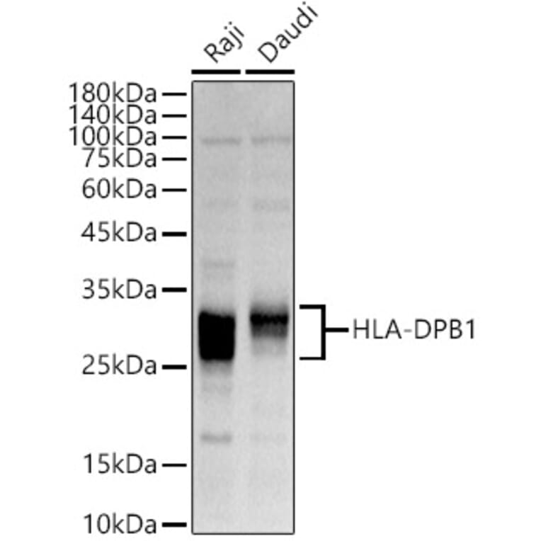 Western Blot - Anti-MHC Class II beta Antibody (A89121) - Antibodies.com