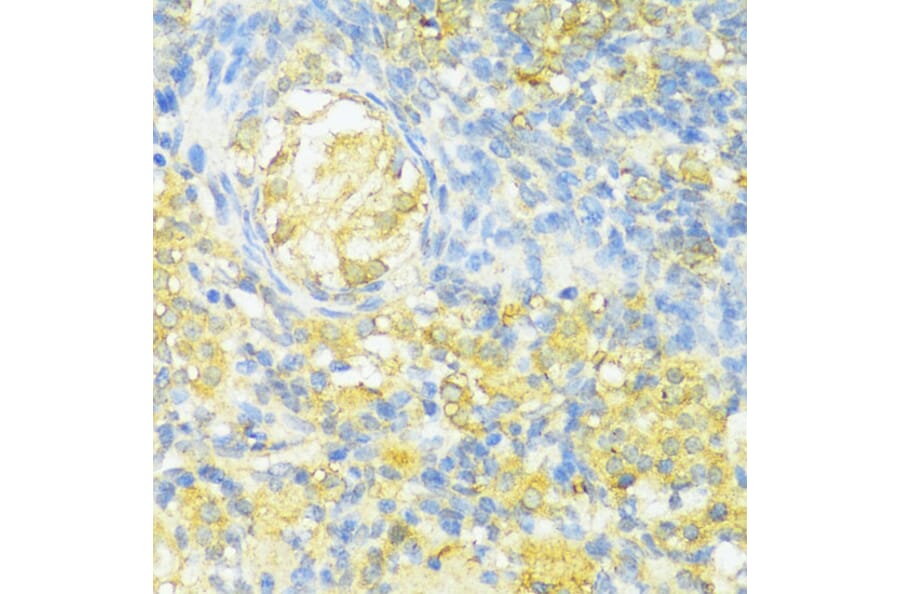 Immunohistochemistry - Anti-MHC Class II beta Antibody (A89121) - Antibodies.com