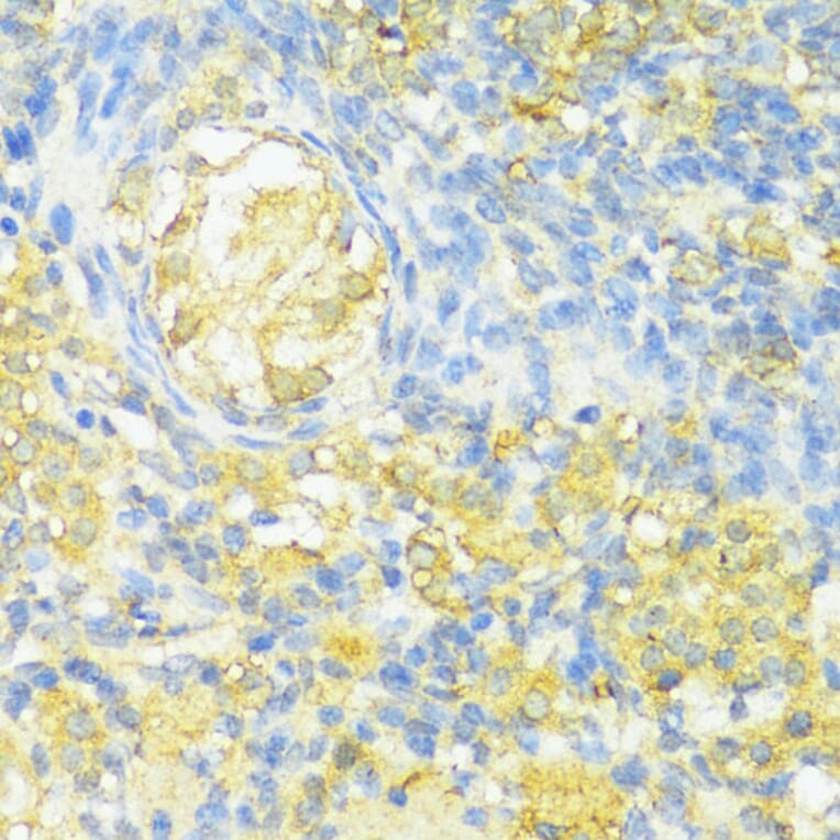 Immunohistochemistry - Anti-MHC Class II beta Antibody (A89121) - Antibodies.com