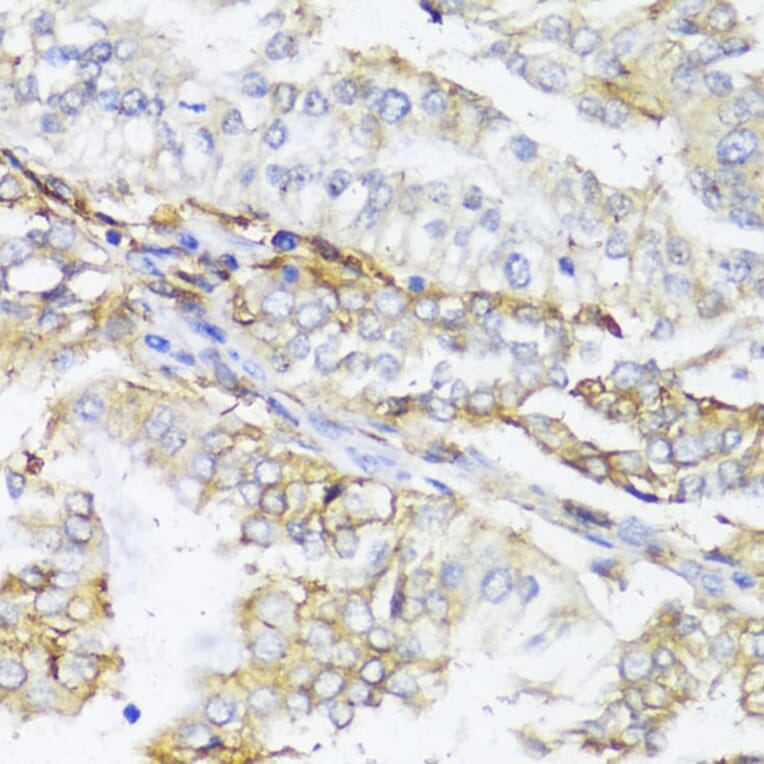 Immunohistochemistry - Anti-MHC Class II beta Antibody (A89121) - Antibodies.com