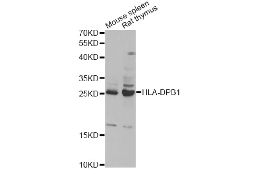 Western Blot - Anti-HLA-DPB1 Antibody (A13997) - Antibodies.com