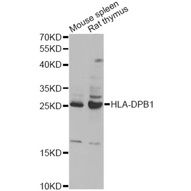 Western Blot - Anti-HLA-DPB1 Antibody (A13997) - Antibodies.com