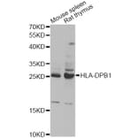 Western Blot - Anti-HLA-DPB1 Antibody (A13997) - Antibodies.com