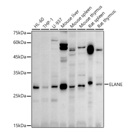 Western Blot - Anti-Neutrophil Elastase Antibody (A89123) - Antibodies.com