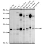 Western Blot - Anti-Neutrophil Elastase Antibody (A89123) - Antibodies.com