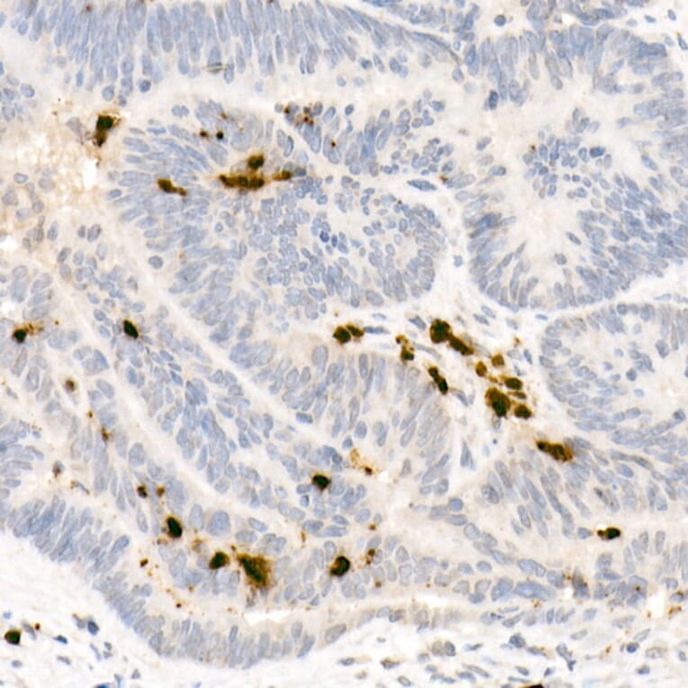 Immunohistochemistry - Anti-Neutrophil Elastase Antibody (A89123) - Antibodies.com