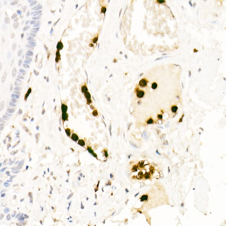 Immunohistochemistry - Anti-Neutrophil Elastase Antibody (A89123) - Antibodies.com