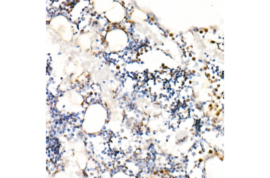 Immunohistochemistry - Anti-Neutrophil Elastase Antibody (A89123) - Antibodies.com