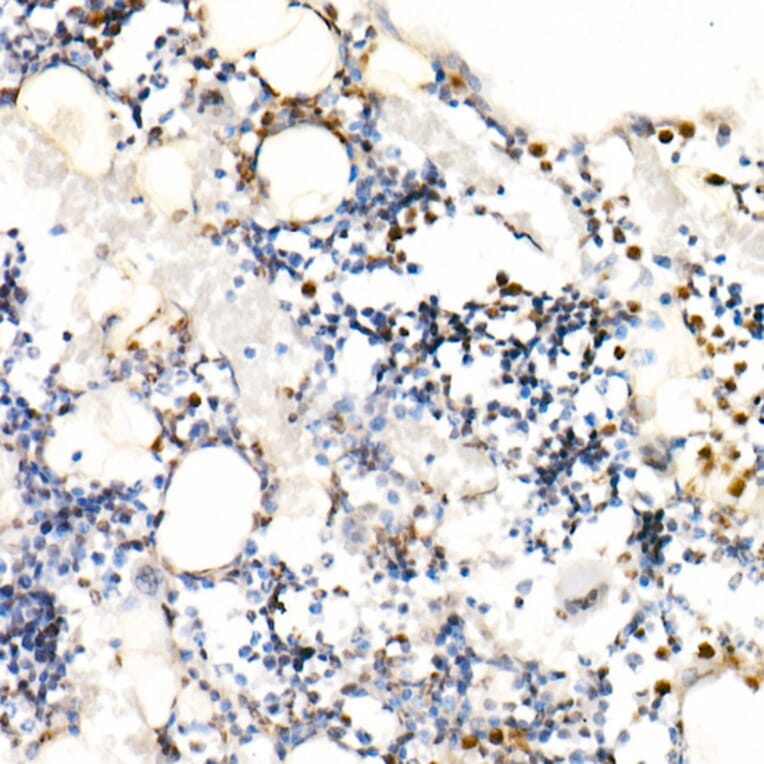 Immunohistochemistry - Anti-Neutrophil Elastase Antibody (A89123) - Antibodies.com