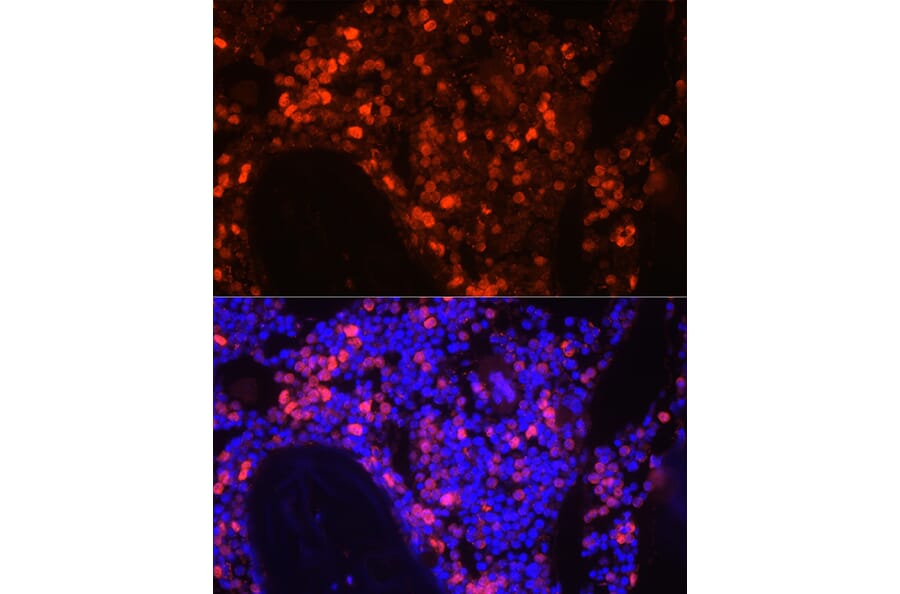 Immunofluorescence - Anti-Neutrophil Elastase Antibody (A89123) - Antibodies.com
