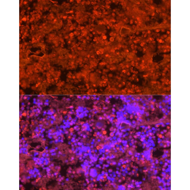 Immunofluorescence - Anti-Neutrophil Elastase Antibody (A89123) - Antibodies.com