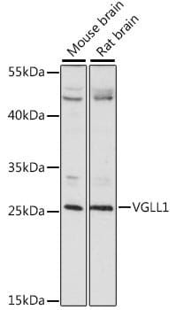 Western blot analysis of extracts of various cell lines, using Anti-VGLL1 Antibody (A15840) at 1:1,000 dilution.
Secondary antibody: Goat Anti-Rabbit IgG (H+L) (HRP) (AS014) at 1:10,000 dilution.
Lysates / proteins: 25µg per lane.
Blocking buffer: 3% non-fat dry milk in TBST.
Detection: ECL Basic Kit (RM00020).
Exposure time: 60s.